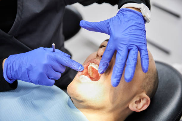 Best Emergency Dental Care for Broken or Chipped Teeth in Crossett, AR